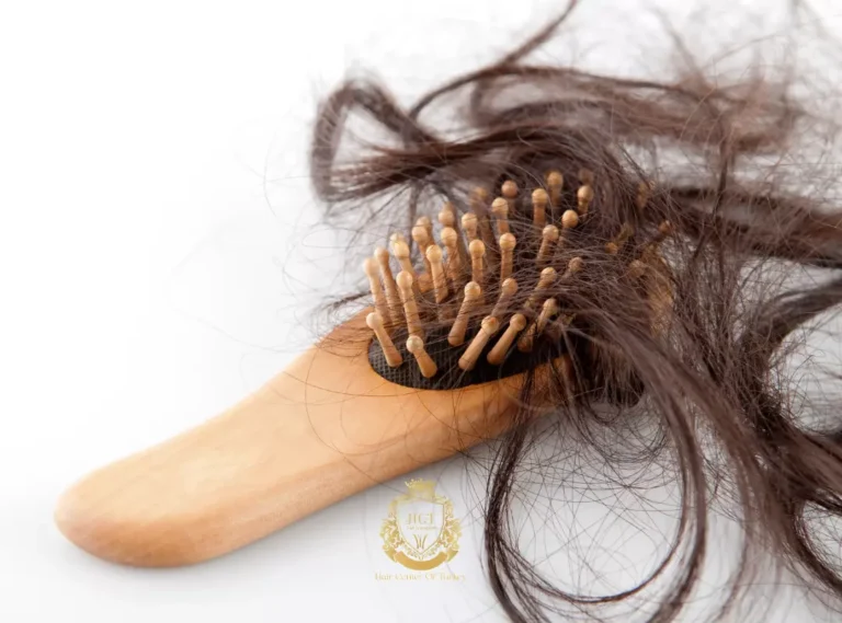 Perché sto perdendo così tanti capelli?