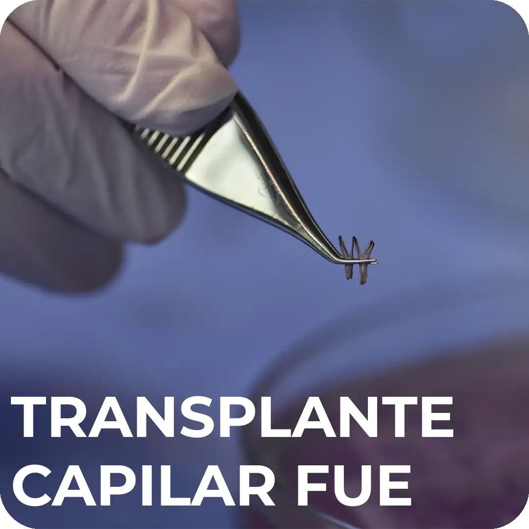 Transplante Capilar FUE