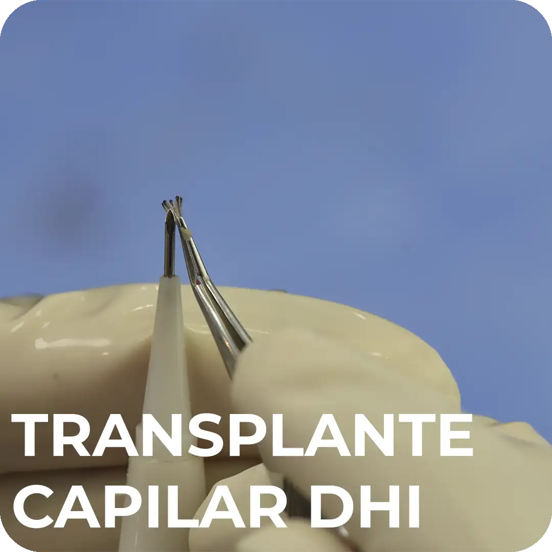 Transplante de Capilar DHI