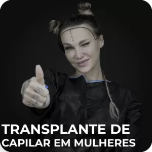 Transplante de Capilar em Mulheres