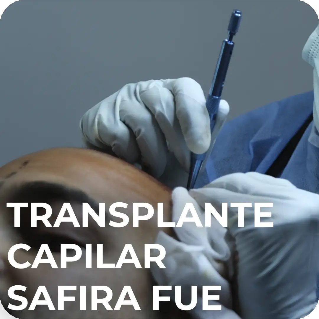 Transplante Capilar Safire FUE