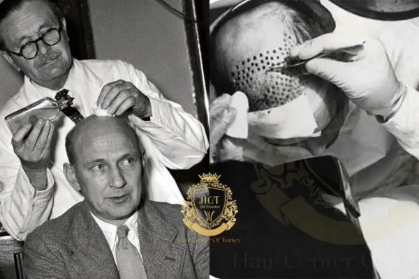 Wer führte die erste Haartransplantation durch?