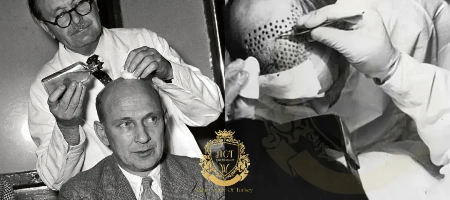 Who is done first hair transplant in world?