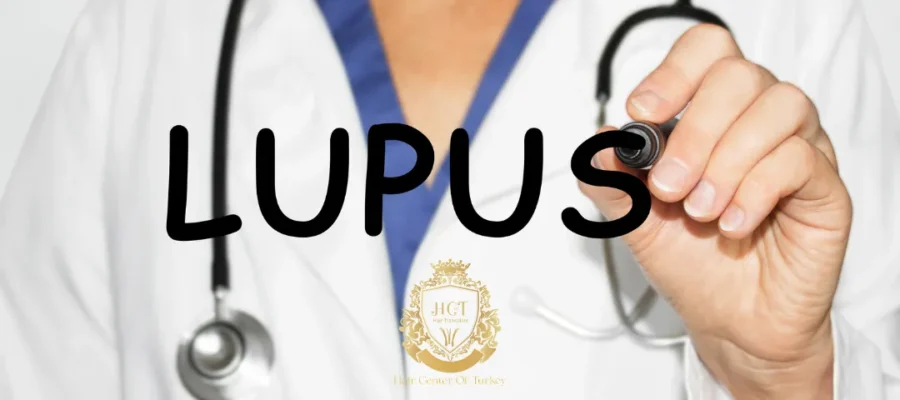 Os pacientes com lúpus podem fazer transplante capilar?