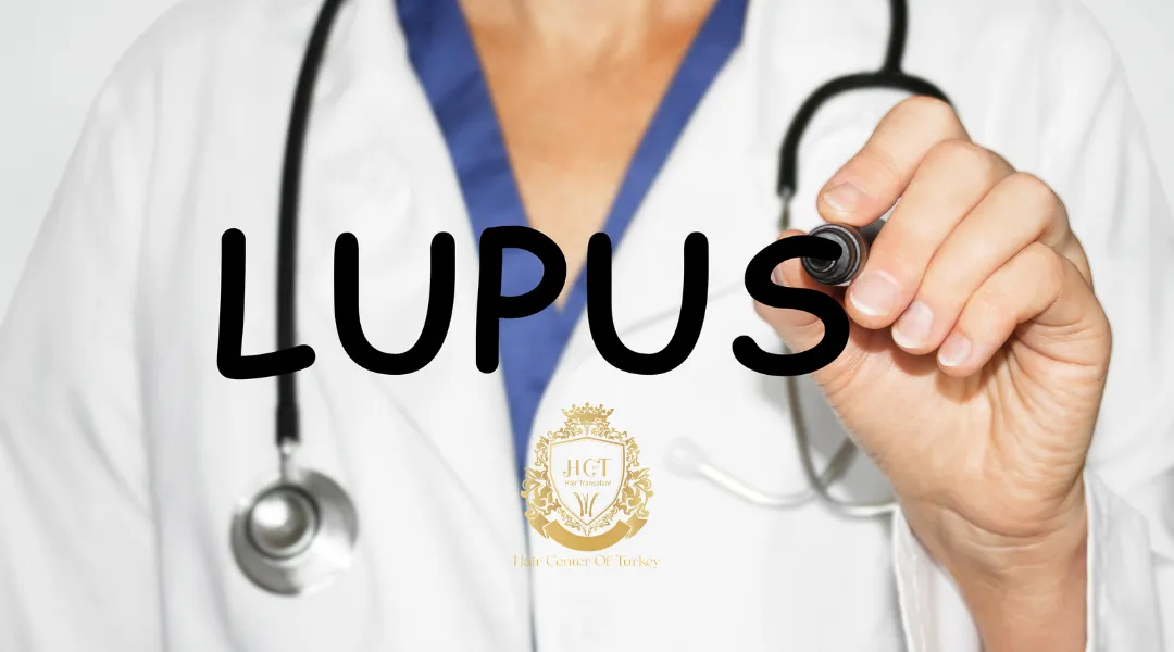 ¿Pueden los pacientes con lupus someterse a un trasplante capilar?