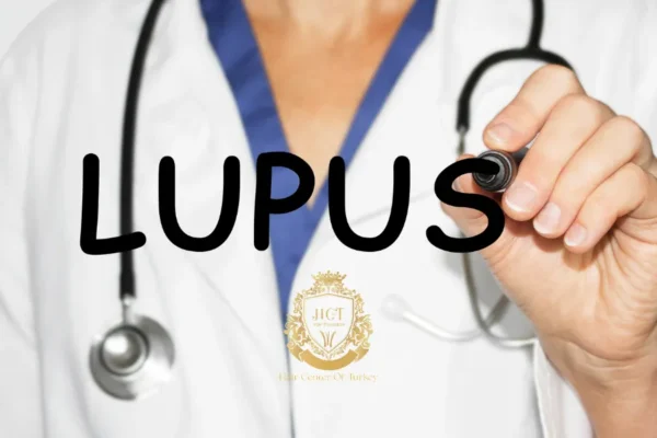 Lupus Hastalarına Saç Ekimi Yapılabilir mi?