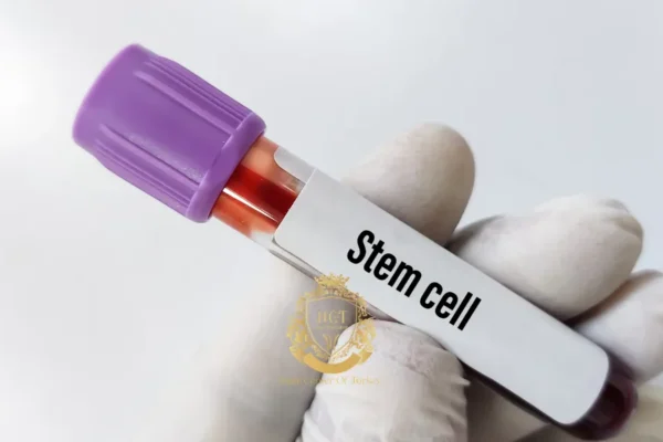 Hair Transplant With Stem Cell Therapy