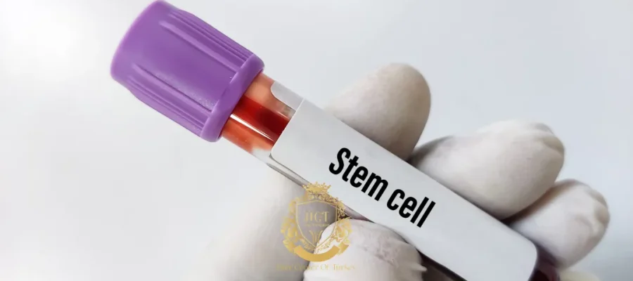 Hair Transplant With Stem Cell Therapy