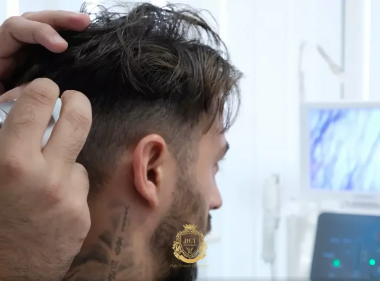 Perdita di capelli negli uomini