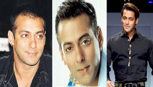 Salman Khan Hair Transplant