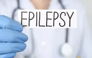 Epilepsi Hastalarina Sac Ekimi Yapilir mi