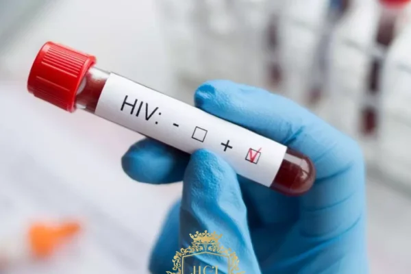 Haartransplantation Bei HIV-Positiven Patienten