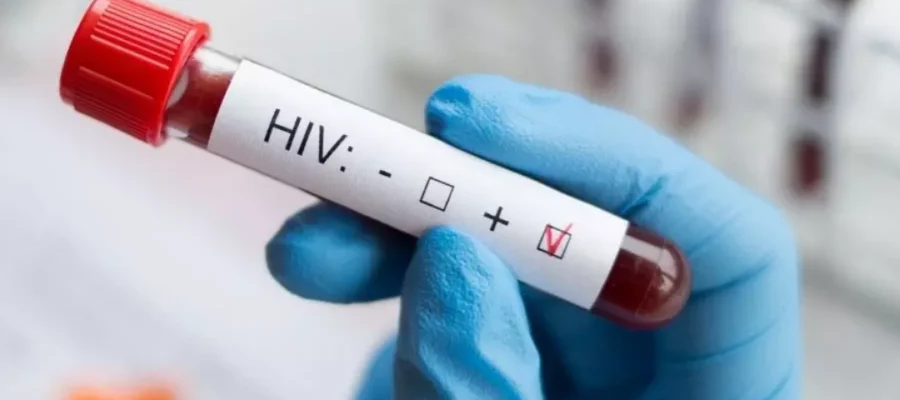 HIV Positive Hair Transplant