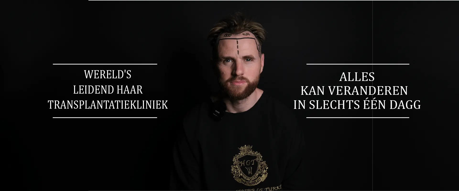 BANNER HANRY flemenkçe-min hair transplant in turkey