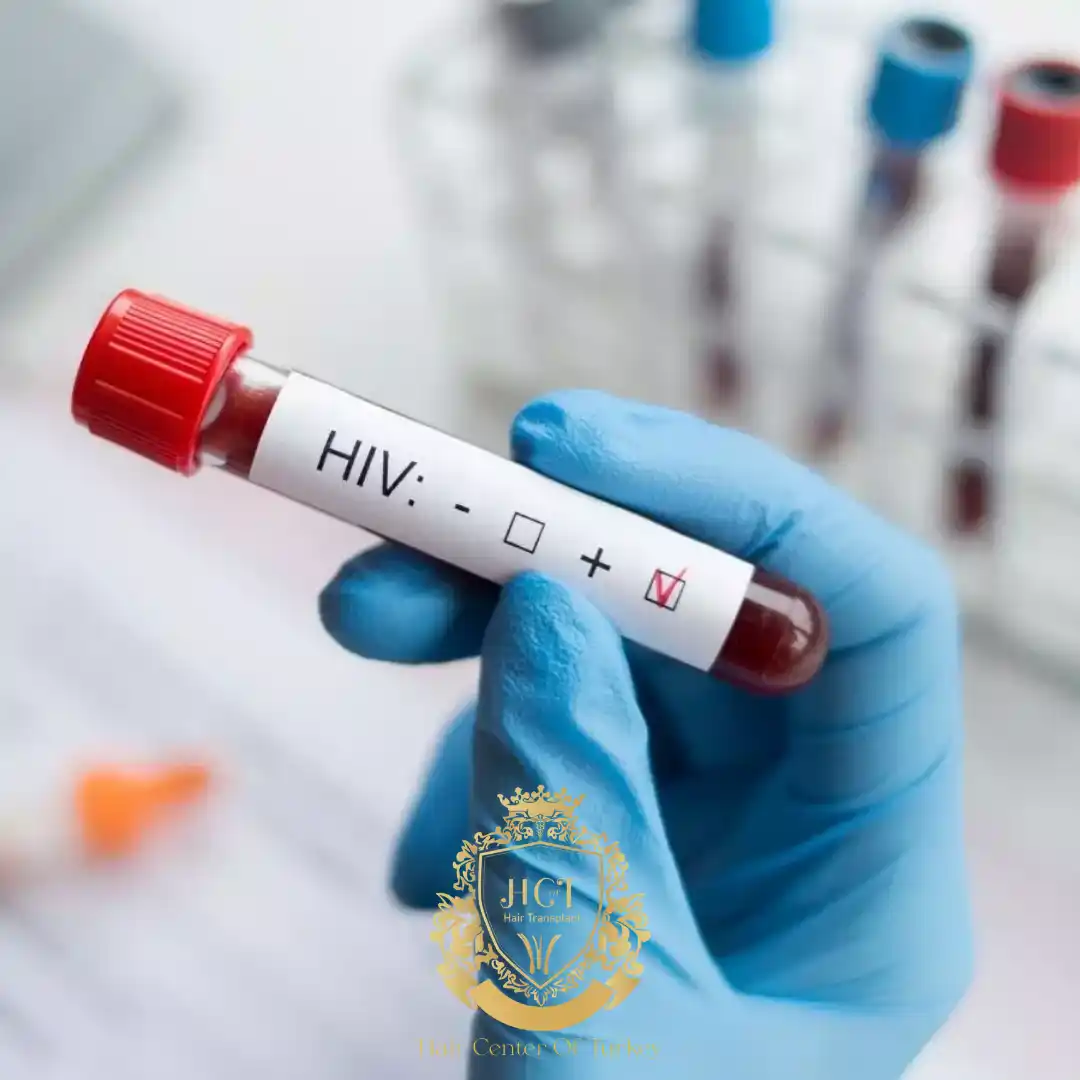 HIV+ Positive Hair Transplant in Turkey