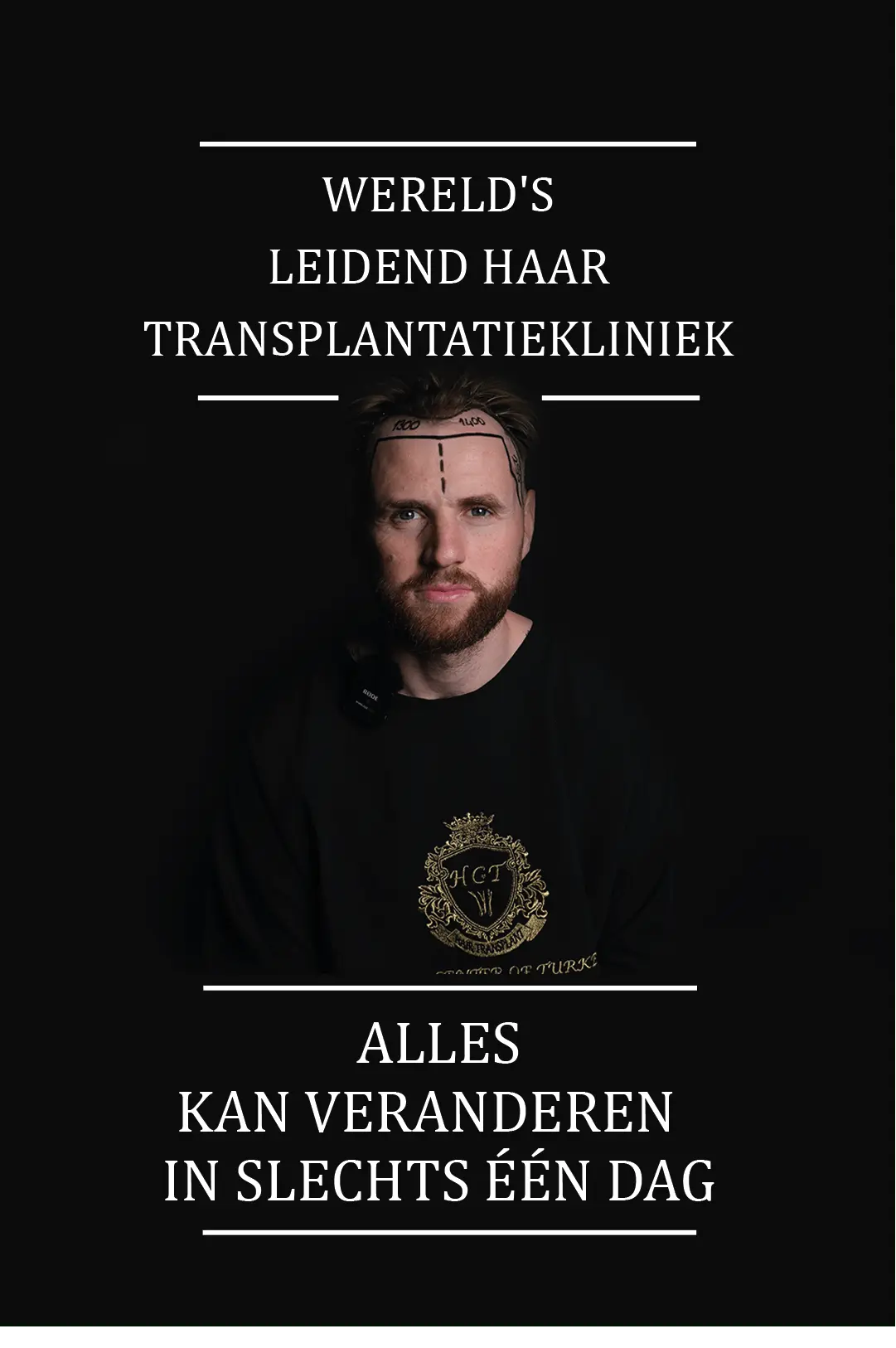 banner hanry TEL flemenkçe-min haar transplantatie kliniek