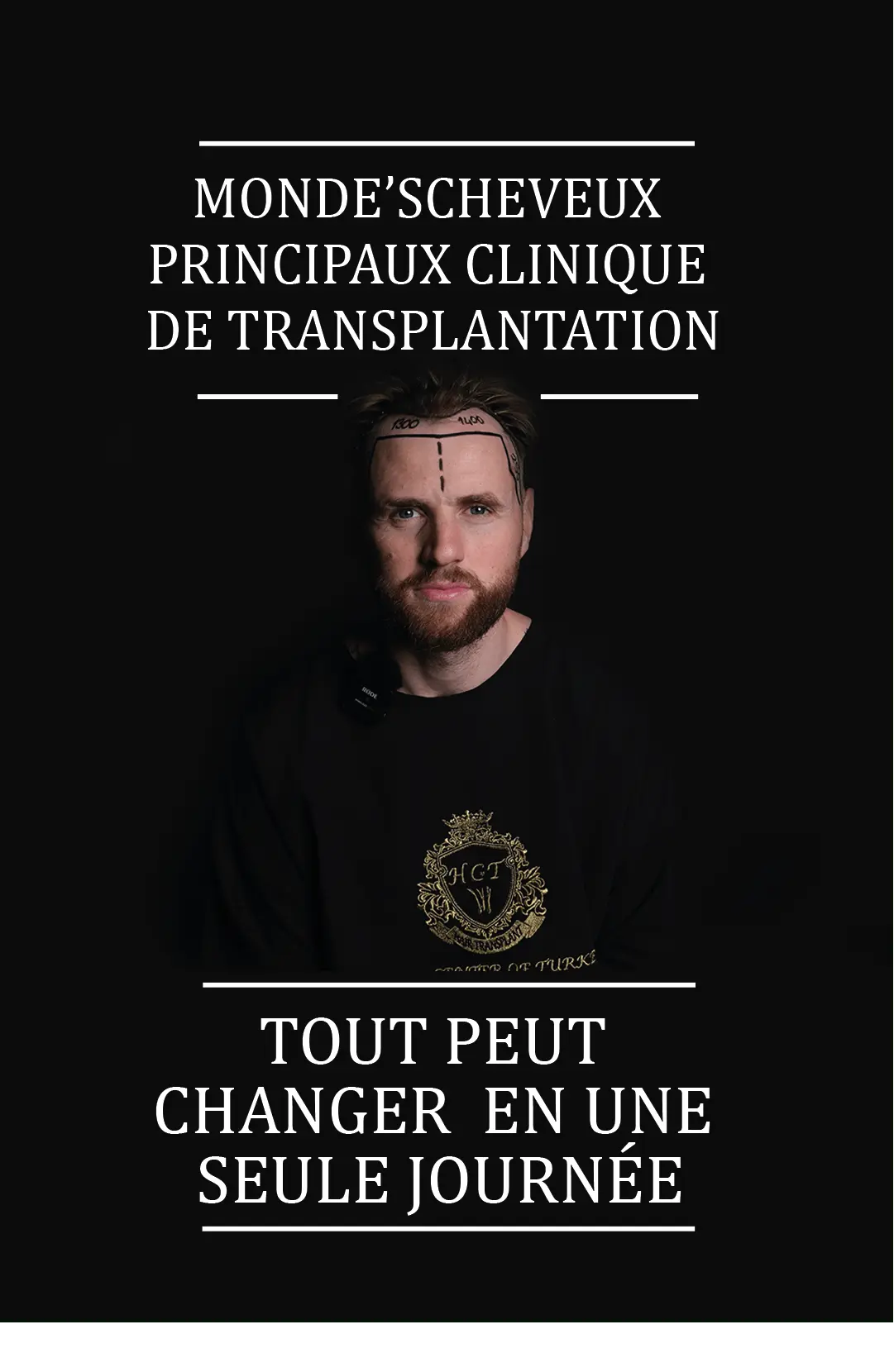 banner hanry TEL fransızca-min greffe de cheveux en turquia