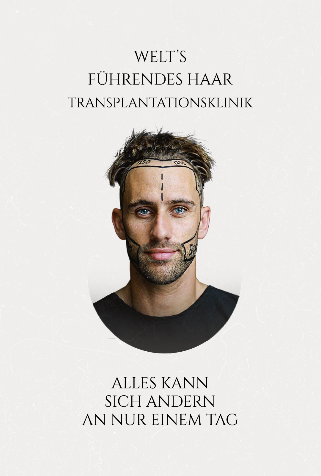 Haartransplantation Türkei-m Haartransplantation Tuerkei m