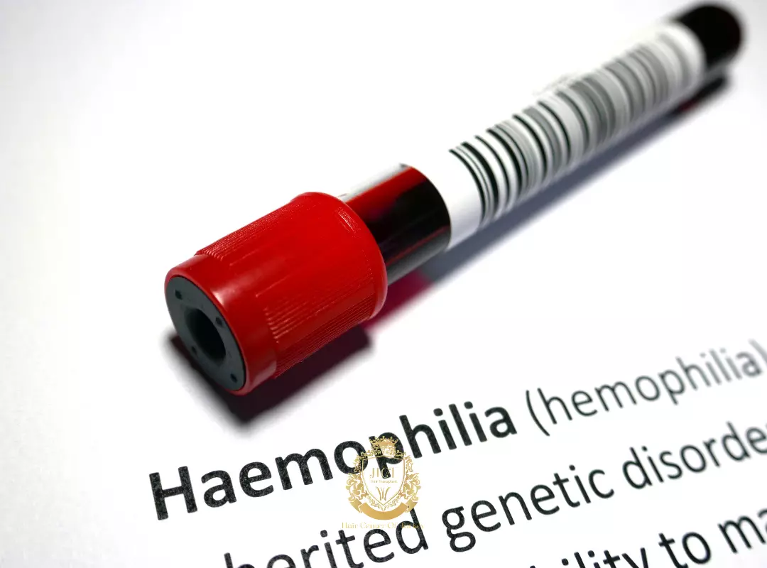 Hemophilia patients