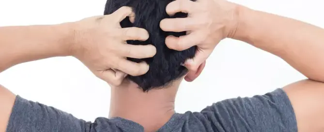 What Can Soothe Your Scalp 1