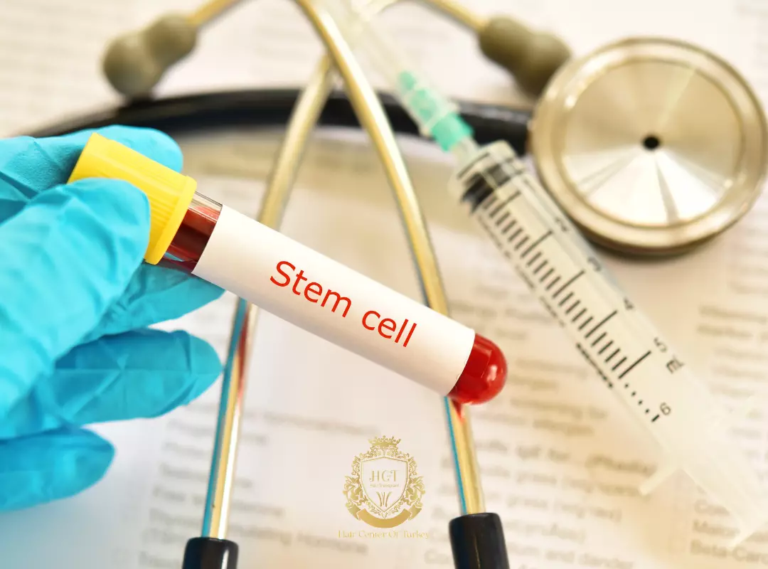 What is Stem Cell