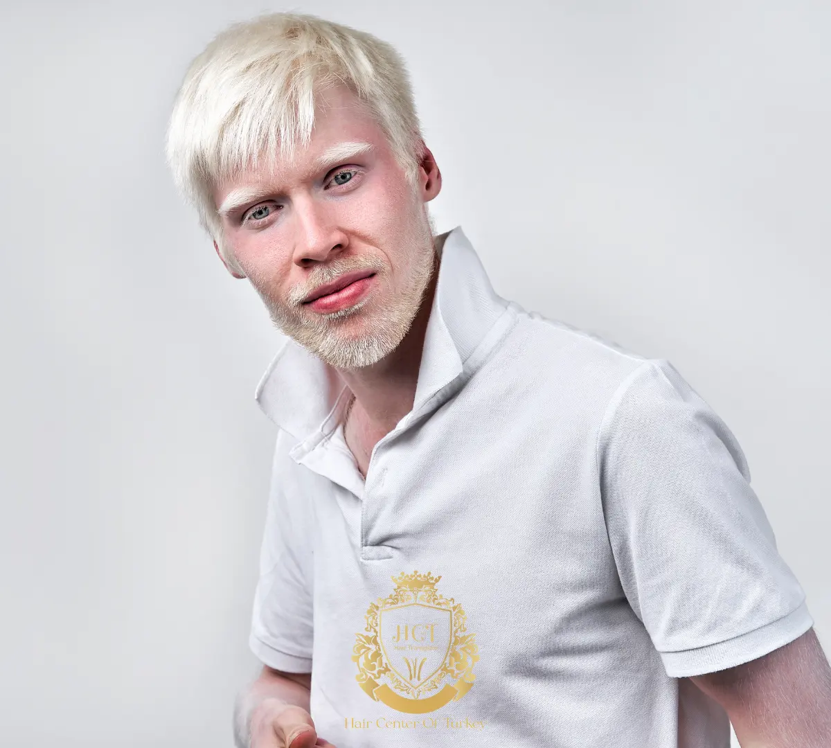albinism hct 1
