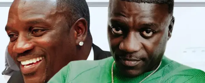 akon hair transplant featured image 1