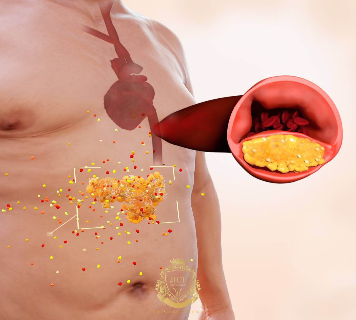 ferritin 1