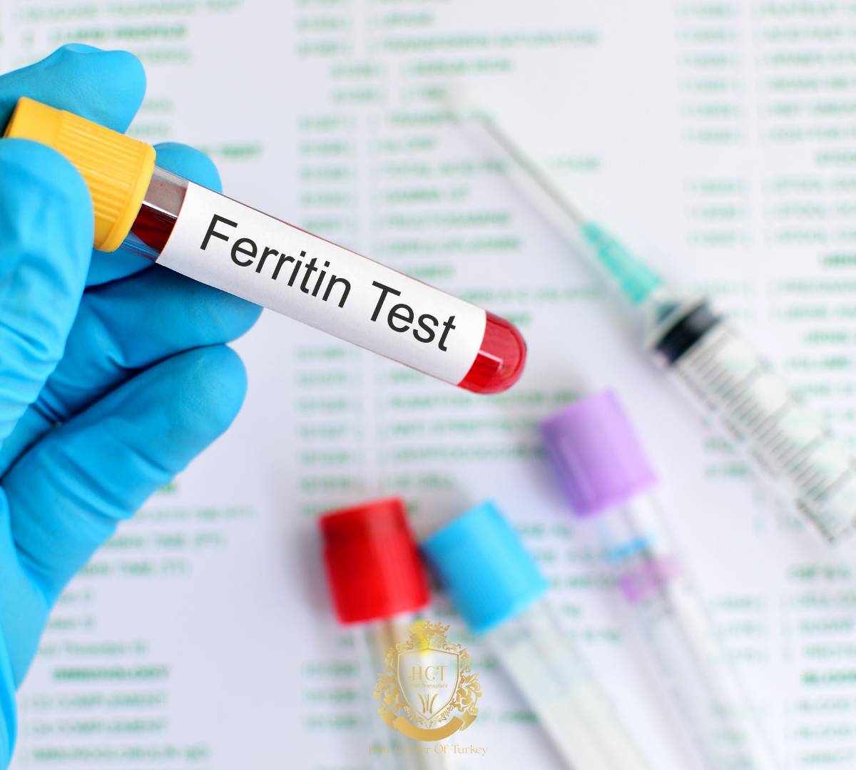 ferritin 2