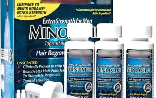 minoxidil hair loss medicine featured image