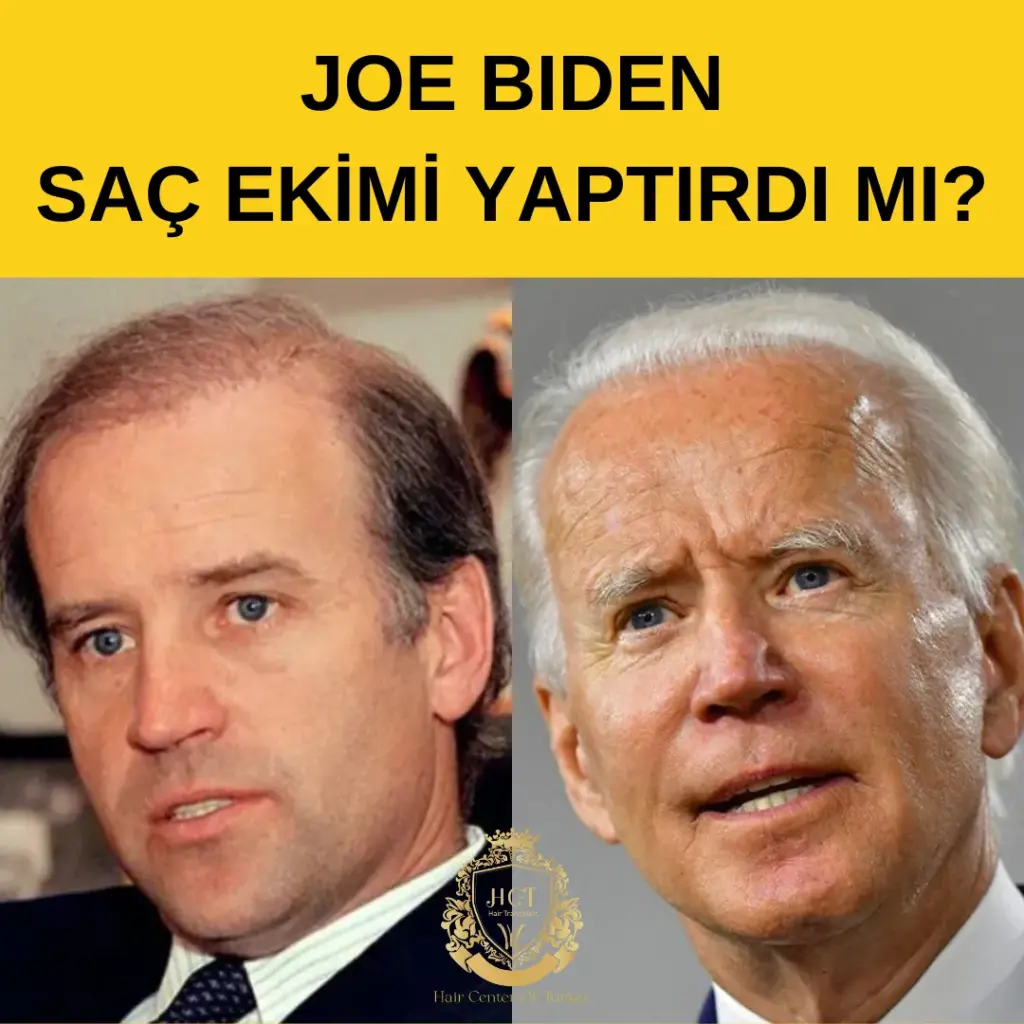 Joe Biden Sac Ekimi One Cikarilan Gorsel