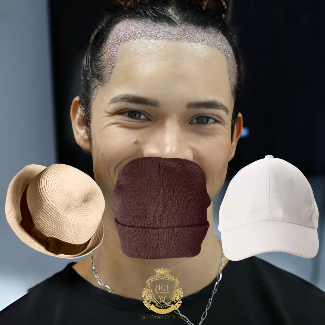 wearing a hat after a hair transplant featured image