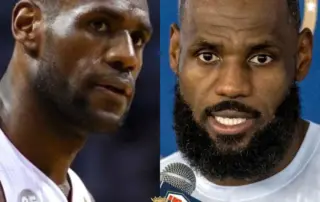 lebron james hair transplant