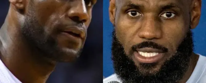 lebron james hair transplant