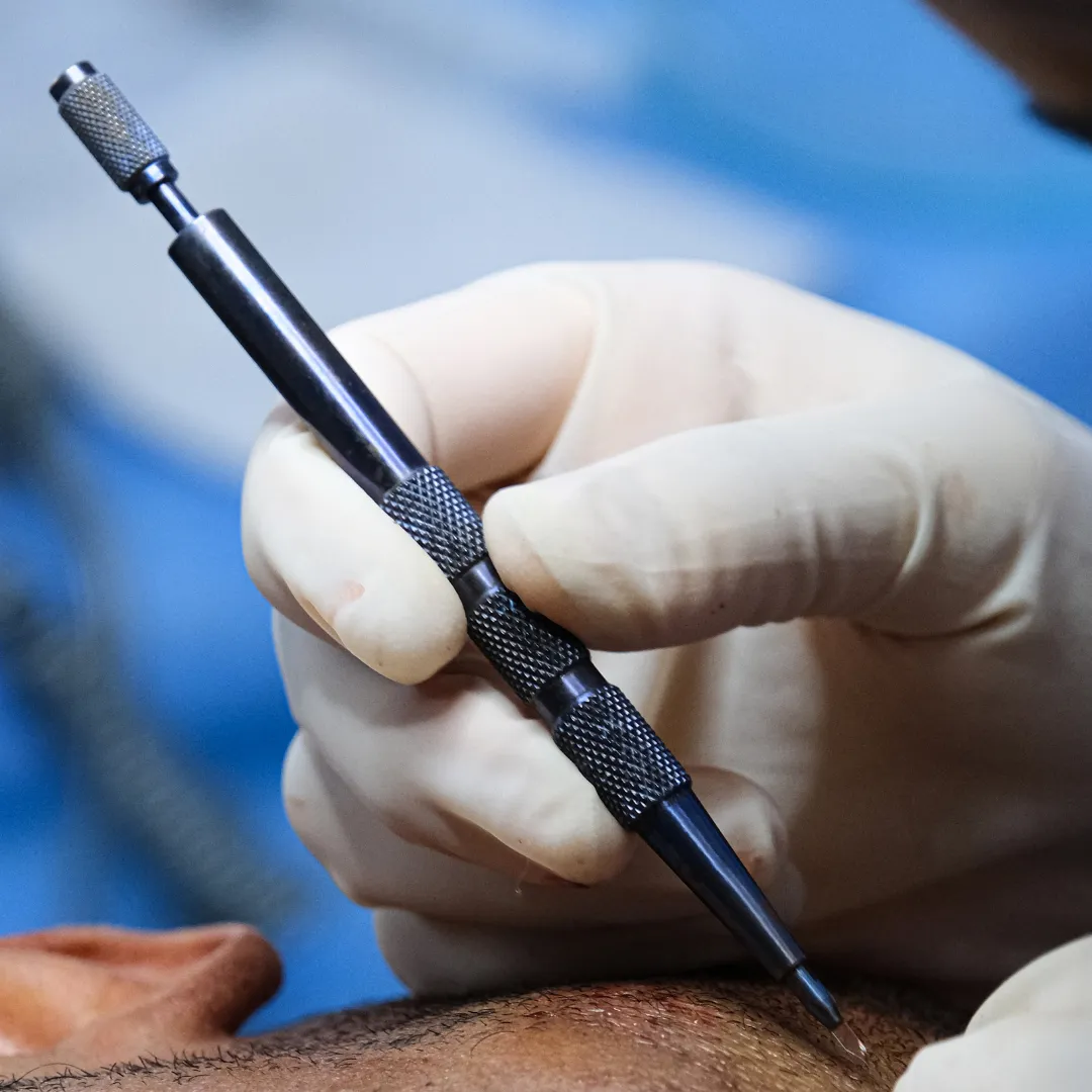 sapphire fue hair transplant technique