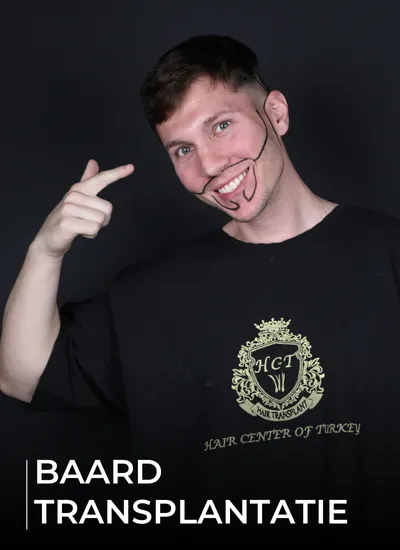 BAARD TRANSPLANTATIE