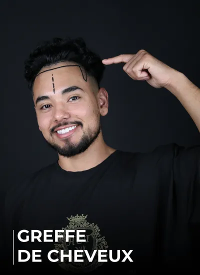 GREFFE DE CHEVEUX