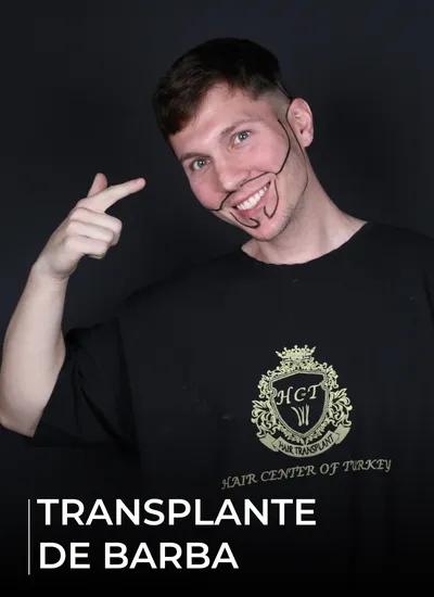 TRANSPLANTE DE BARBA