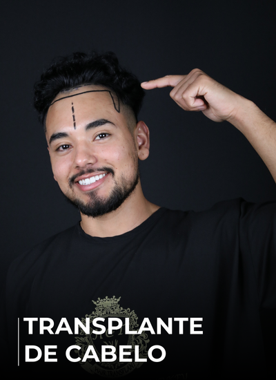 TRANSPLANTE DE CABELO