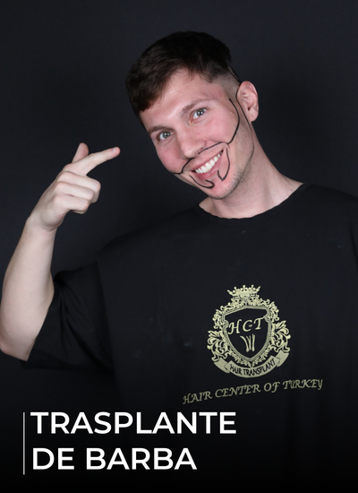 TRASPLANTE DE BARBA