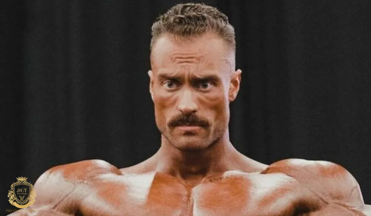 chris bumstead hair transplant