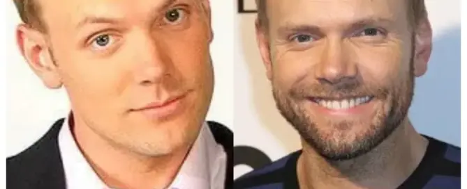 joel mchale hair transplant