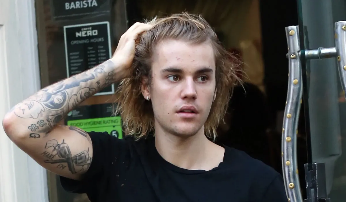 justin bieber hair transplant