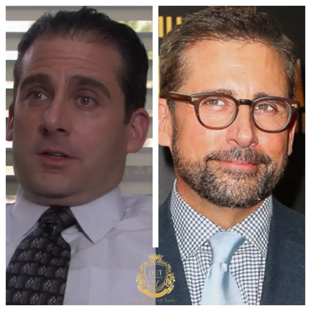 steve carell hair transplant