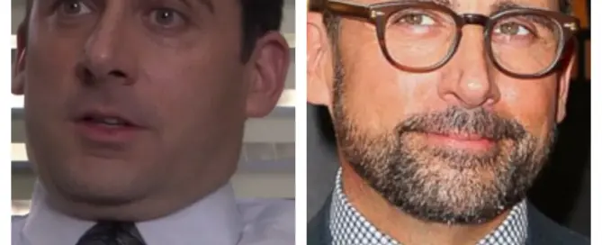 steve carell hair transplant