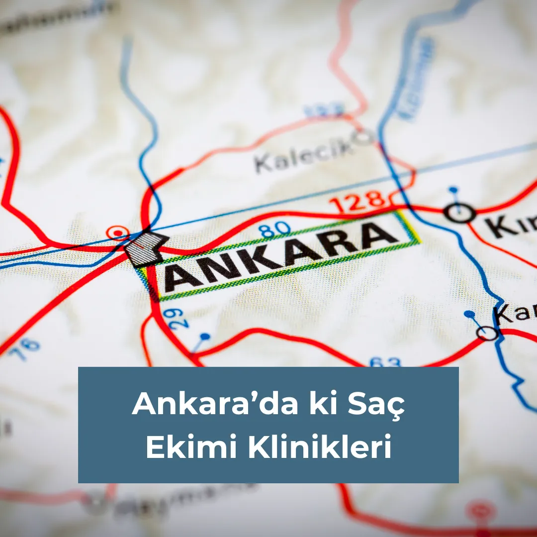 Ankara'da ki Saç Ekimi Klinikleri