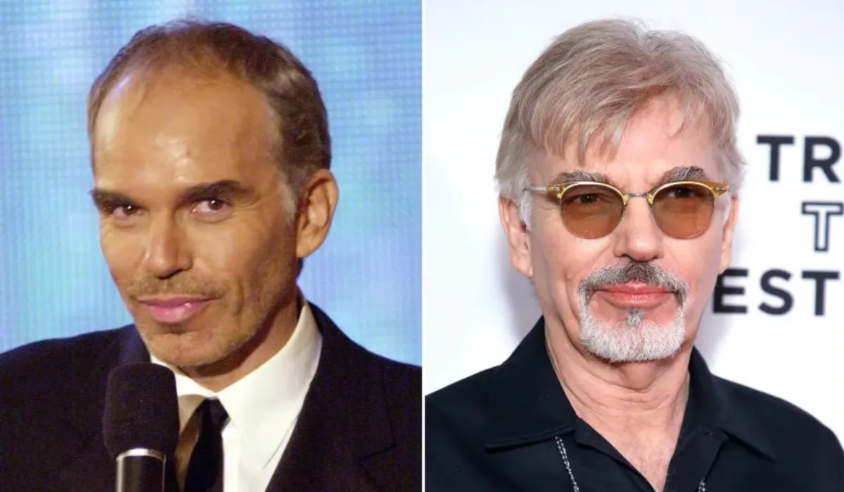 Billy Bob Thornton Hair Transplant