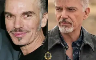 Billy Bob Thornton Hair Transplant