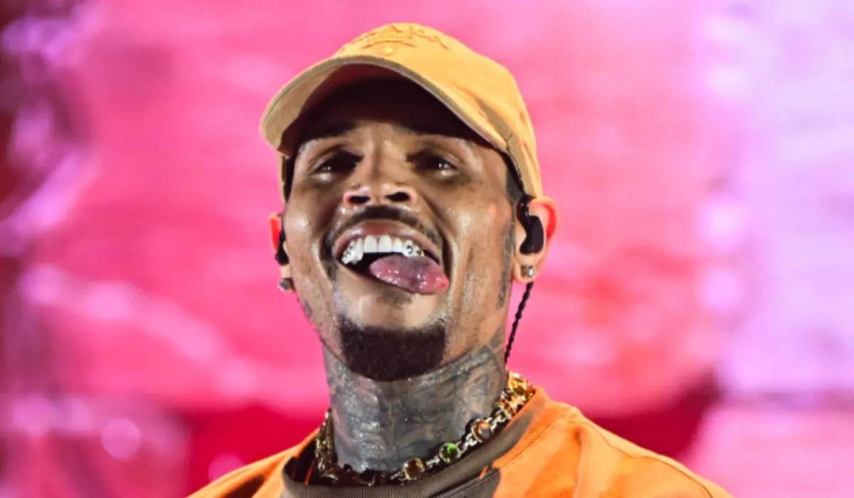 Chris Brown Hair Transplant