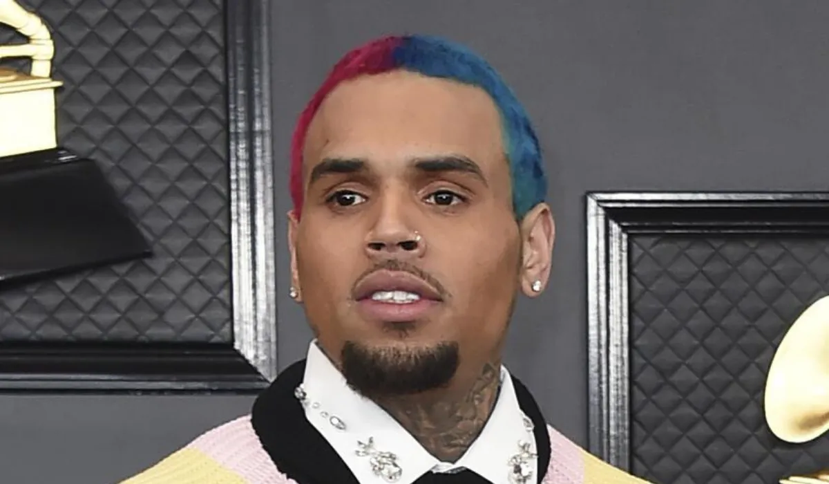 Chris Brown Hair Transplant